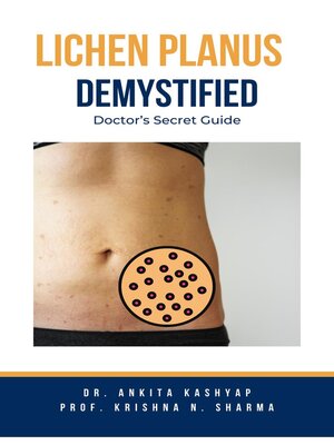 cover image of Lichen Planus Demystified Doctors Secret Guide